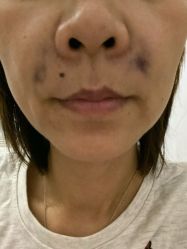 -坤如玛丽·医疗美容中心