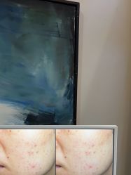 -苑苑vbeauty科技美容SPA