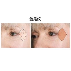 -上海漾颜医疗美容