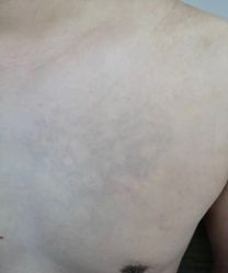 -天道专业洗纹身