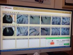 -丝客富脱发养发头皮馆