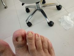 -新甲连锁灰指甲·甲沟炎·鸡眼(黑龙江路店)