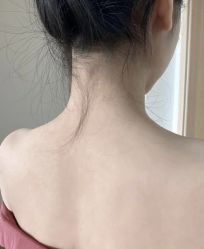 -SOR索尔祛痘·面部肌肤管理