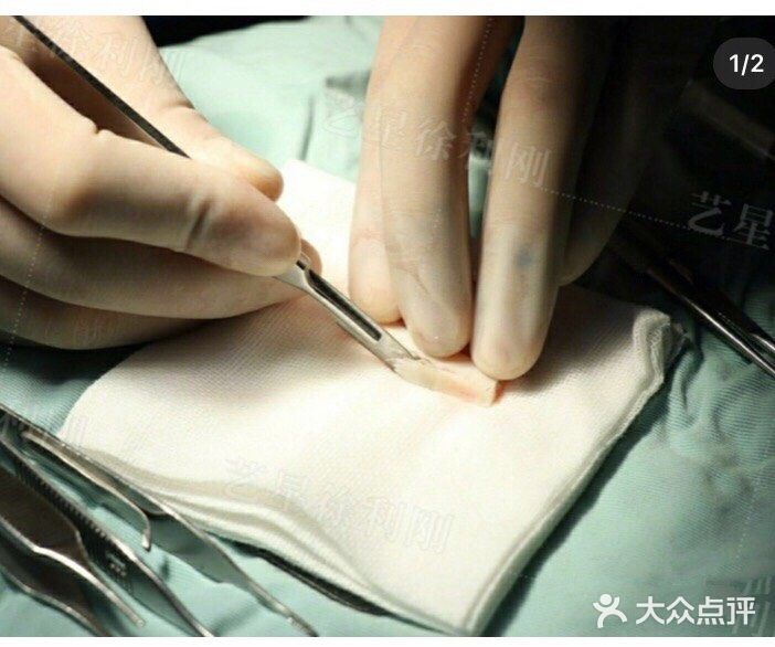 塌鼻子如何变立体？【案例详解】