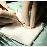 塌鼻子如何变立体？【案例详解】