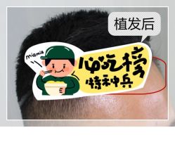 -大麦微针植发全国连锁