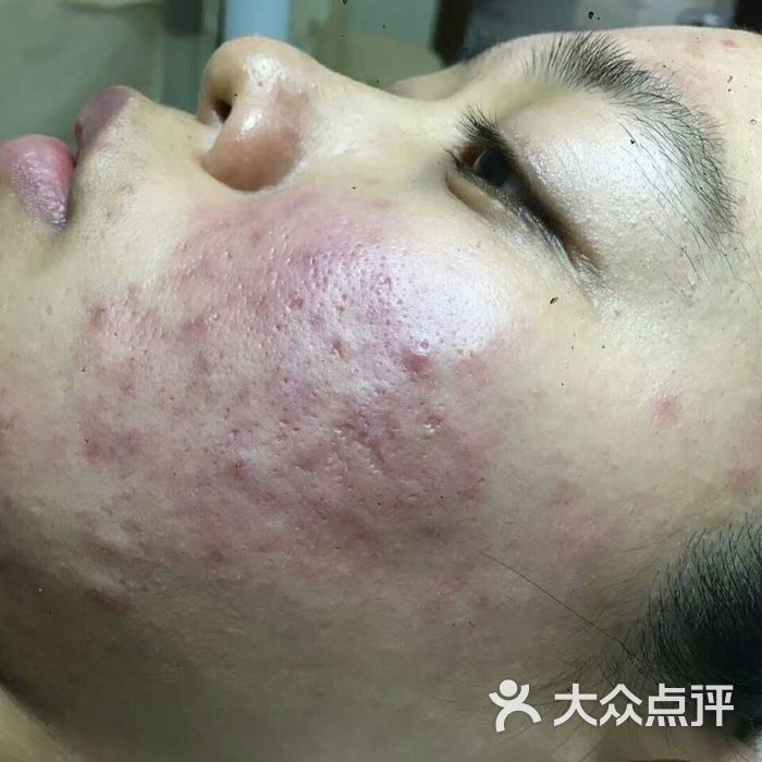 sor    索尔专业祛痘国际连锁