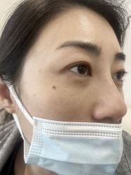 -清疣美疣·痣·斑净肤中心