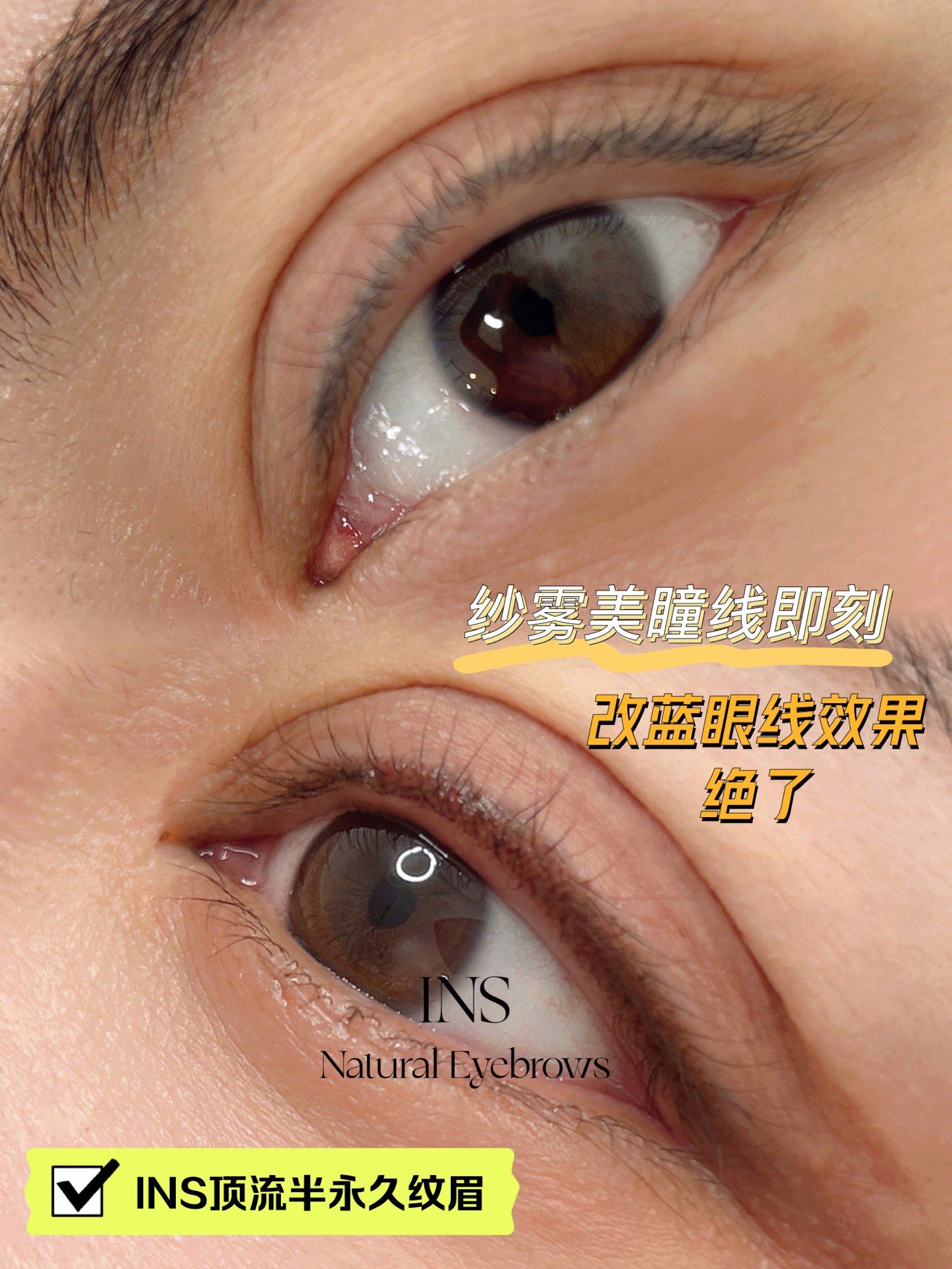 纱雾美瞳线改蓝眼线效果超级棒 自然零结痂