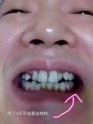 康容堂脸部健康中心(福州康容堂东街店)-康容堂·专业祛痘·皮肤管理中心