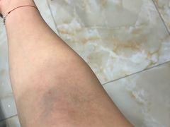 -上海美兆健康医疗体检中心(古北店)