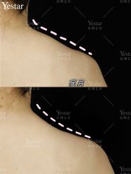 -Yestar艺星医疗美容医院