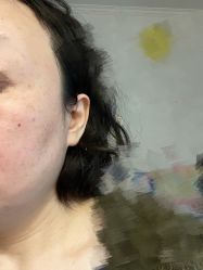 -荟草堂专业痘肌皮肤管理