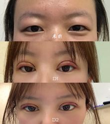 -成都西区医院整形美容