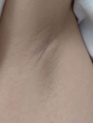 体验后-南京医科大学友谊整形外科医院