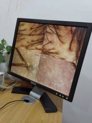 -章光101防脱养发荟