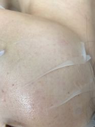 -长沙雅美医疗美容医院