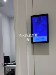体验前-广州美莱医疗美容医院