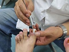 -新甲连锁灰指甲·甲沟炎·鸡眼(黑龙江路店)