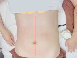 -Lily纤美·科技减脂中心