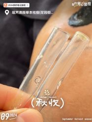-瑶芳清颜草本祛痘