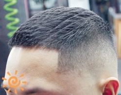 -大麦微针植发丨全国连锁