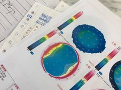 -上海大学附属上海和平眼科医院