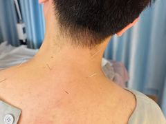 -承启堂中医馆·推拿·针灸(成华馆)