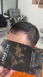 -发饰美男士增发补发假发定制店