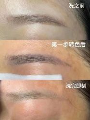 -郡艺医疗美容·微整·眼鼻吸脂