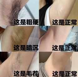 -薇兰专业脱毛连锁机构