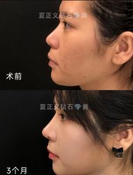 -北京米扬丽格医疗美容·联合丽格鼻整形中心
