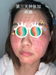 -海涛医疗美容·面部抗衰·注射美鼻