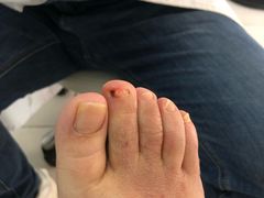 -新甲连锁灰指甲·甲沟炎·鸡眼(黑龙江路店)