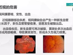 -华彬眼镜专业渐进配镜(潘家园店)