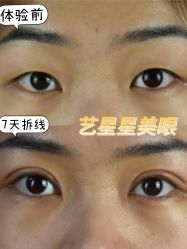 点击看大图 -Yestar重庆艺星医疗美容医院