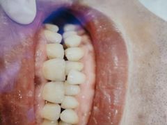 -宁波壹加壹口腔·矫正种植中心