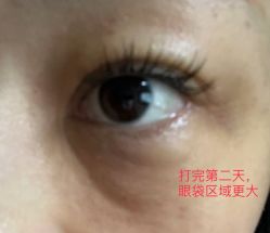 体验后-深圳广和门诊部·整形医疗美容