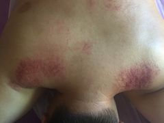 -沈师傅盲人按摩工作室(密三小区店)