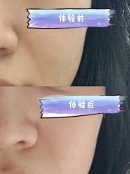 -广州美莱医疗美容医院