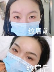 -Doris多里斯半永久纹眉·SMP纹发·发际线