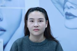 -丰联丽格医疗美容·联合丽格眼整形中心