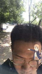 -大麦微针植发丨全国连锁