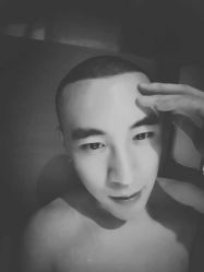 -大麦微针植发丨全国连锁