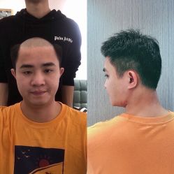 -发饰美男士增发补发假发定制店