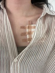 -海涛医疗美容·面部抗衰·注射美鼻