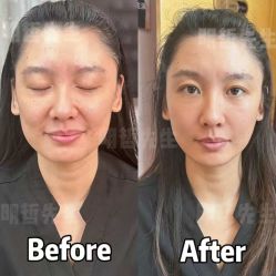 -颜和骨正&明星徒手小颜整骨