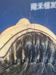 -雍禾植发全国连锁