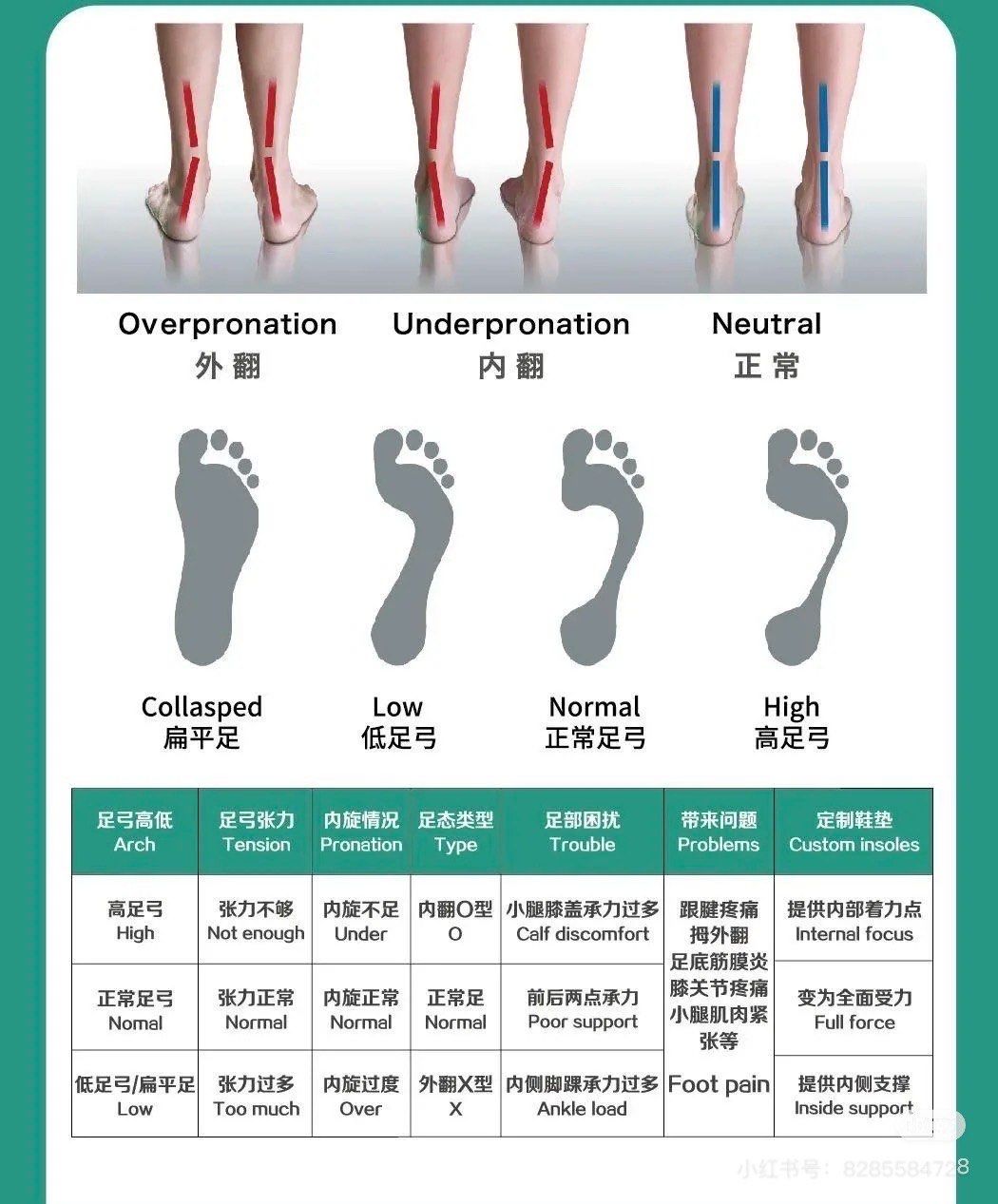 足弓作用这么大