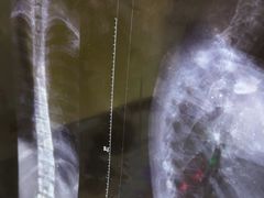 -张钰强中医正骨推拿连锁(华发商都店)
